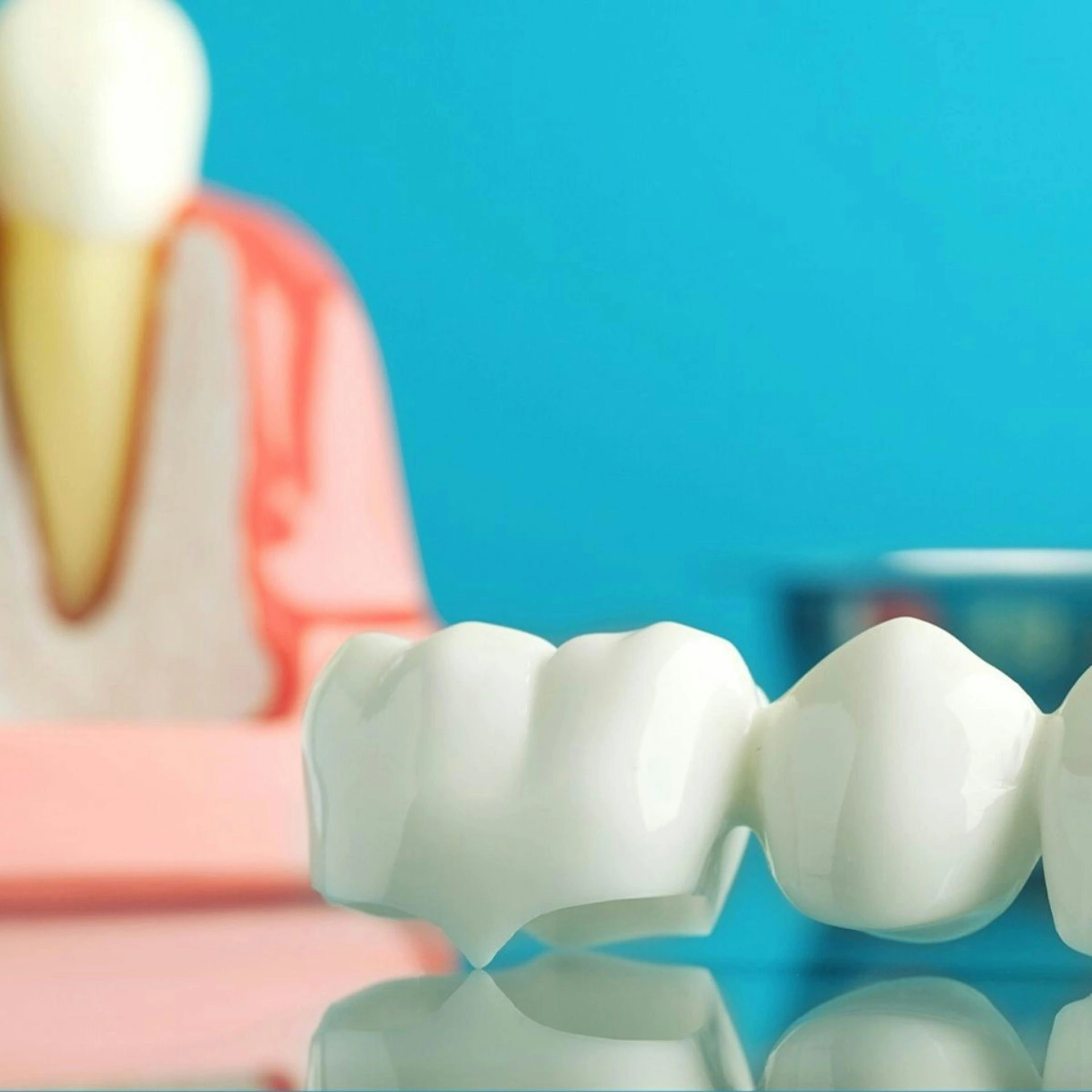 Ceramic Crowns and Bridges Fixing
